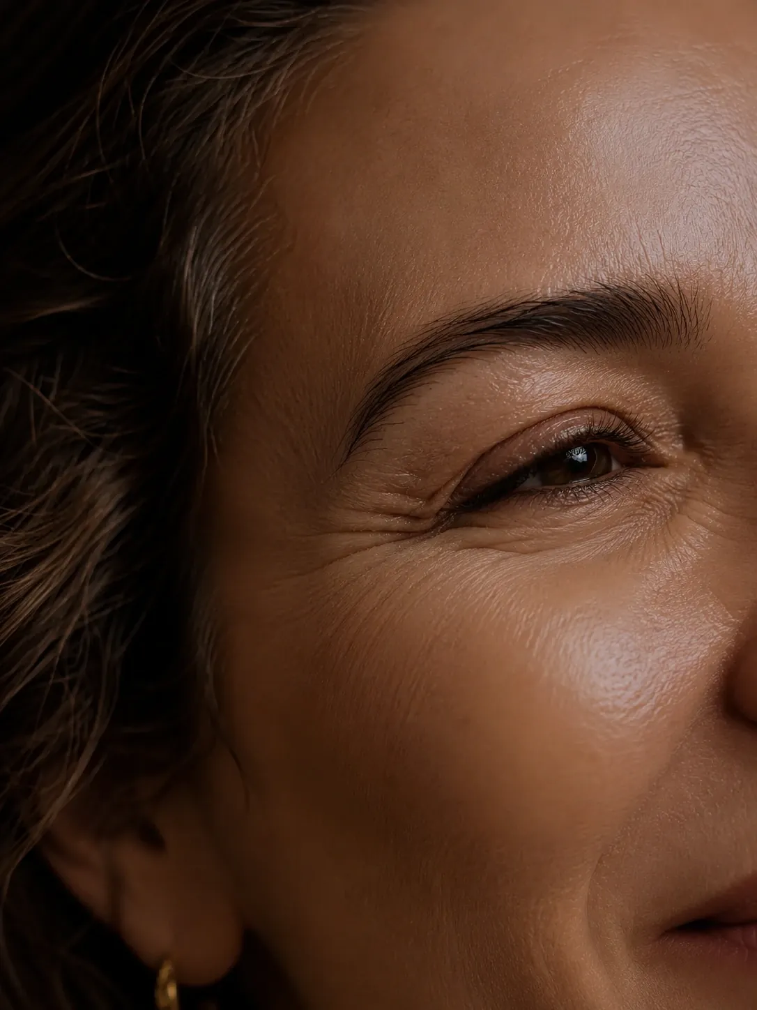 Aplicação de botox em Ipiranga pela Dra. Eduarda Modesto