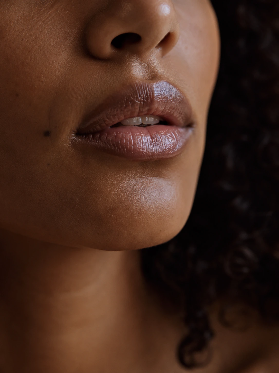 Preenchimento labial em Ipiranga